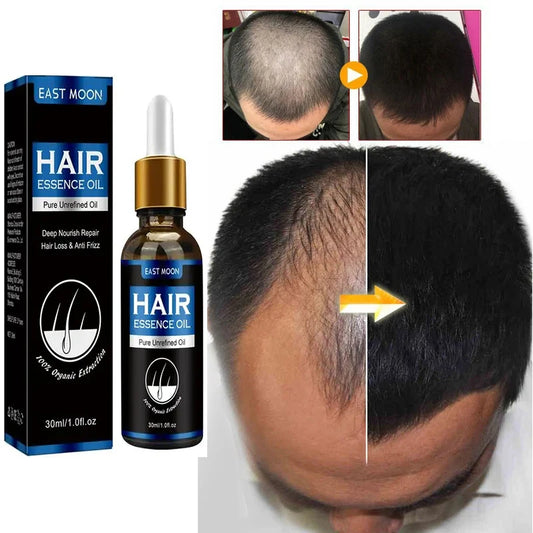 Hair Growth Oil Rapid Effective Repair Baldness Hair Follicles Hereditary Hair Loss Postpartum Hair Loss Seborrheic Hair Care